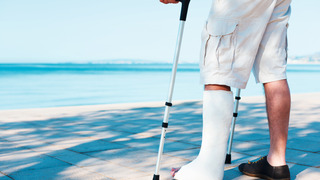 Mann mit Gips Urlaub
